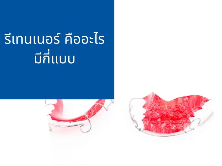 รีเทนเนอร์ คืออะไร มีกี่แบบ ประเภทไหนดี