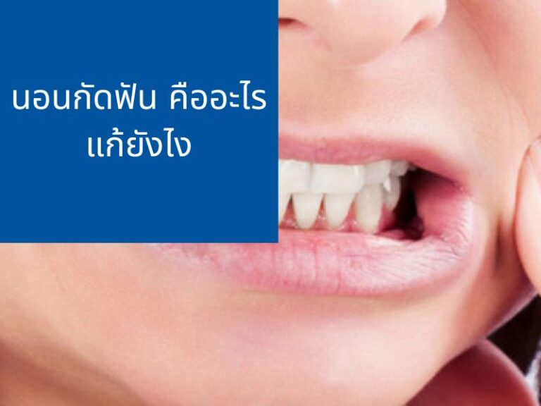 นอนกัดฟันเกิดจากอะไร แก้ยังไง ส่งผลอย่างไรต่อสุขภาพของฟัน